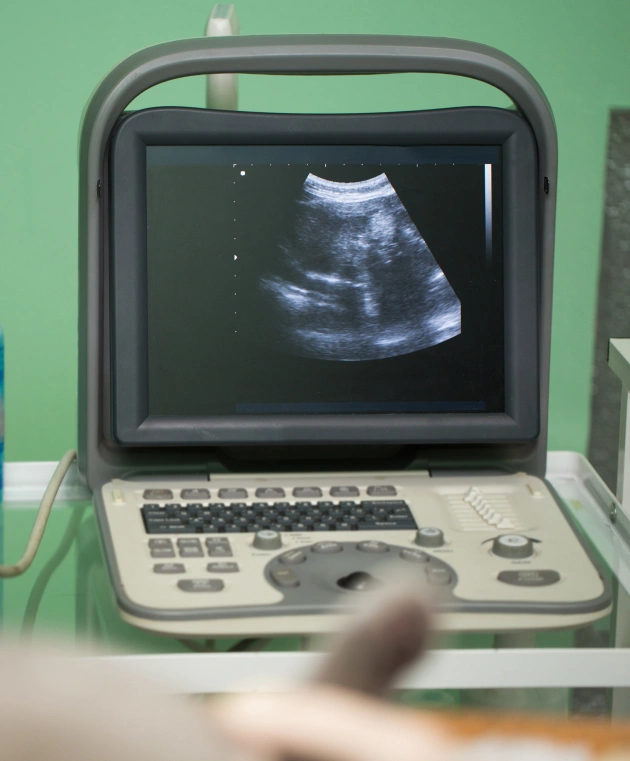 Testing for Feline Leukemia and Feline Immunodeficiency Virus