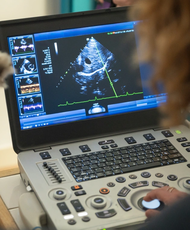 Endoscopy for Detailed Internal Examination